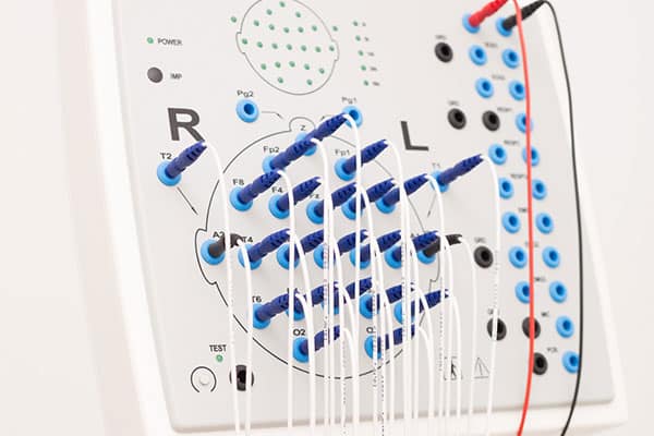 Neurologie-und-Epileptologie-4