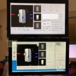 Darstellung-von-Bildgebung-am-PC-Visualase-OP