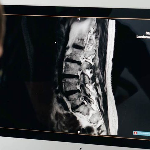 Diagnose Rückenschmerzen