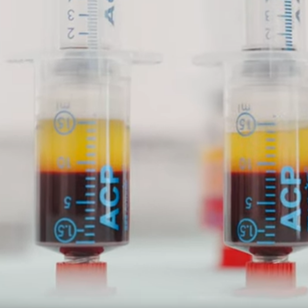 Wunderwaffe gegen Arthrose