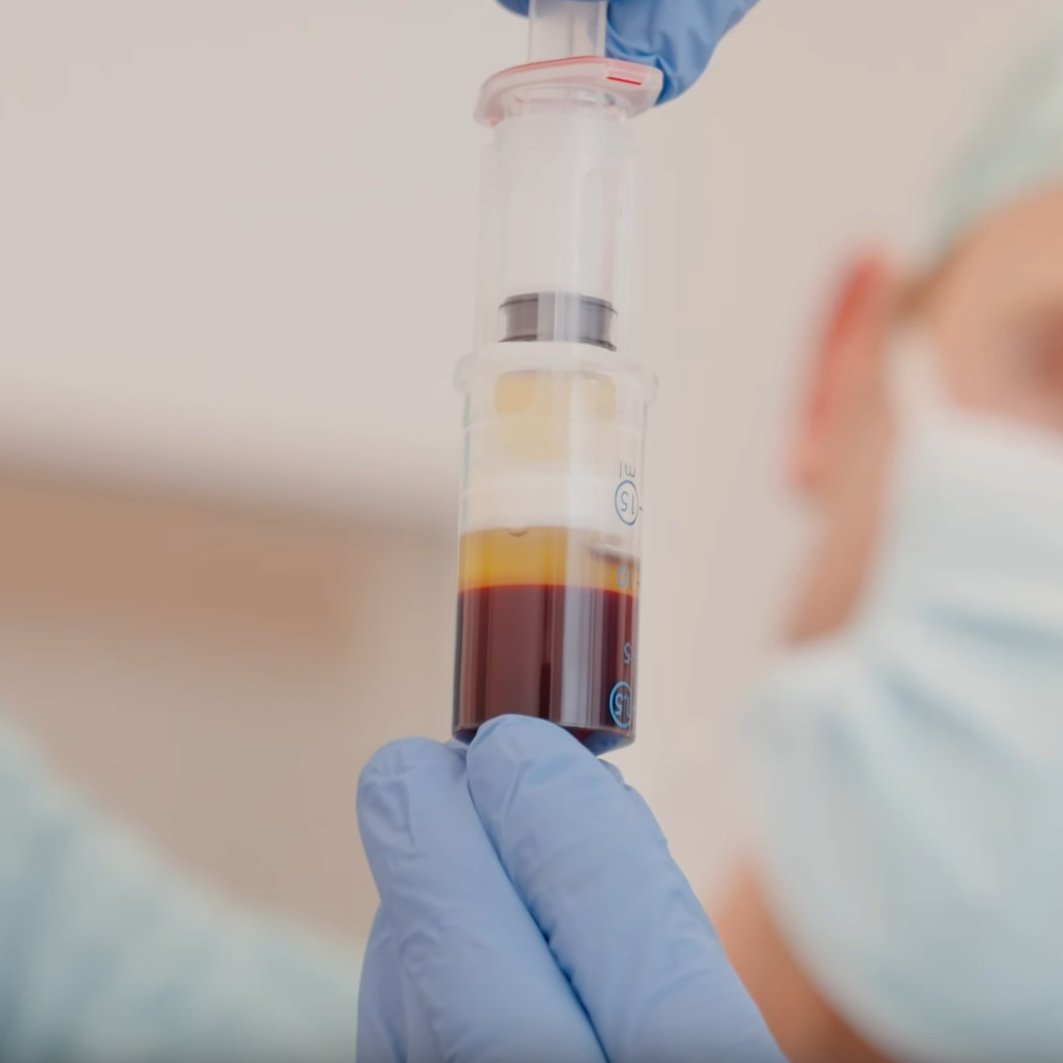 Aufbereitetes Konzentrat