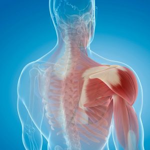 Schulterschmerzen Grafik Schultermuskeln