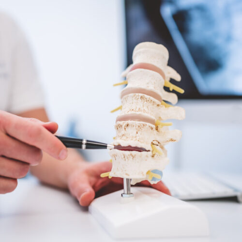 Hausarzt Oster in Bonn zeigt Wirbelsäule