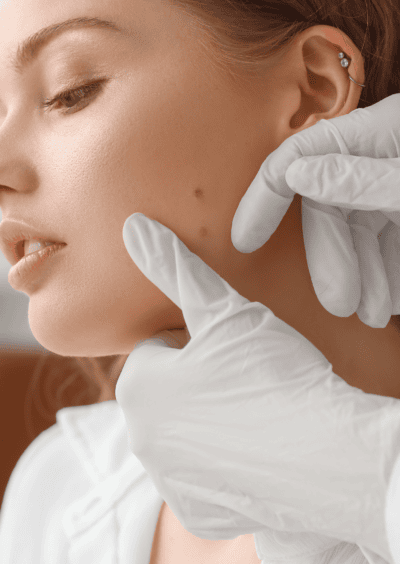 Frau mit Muttermalen im Gesicht wird untersucht