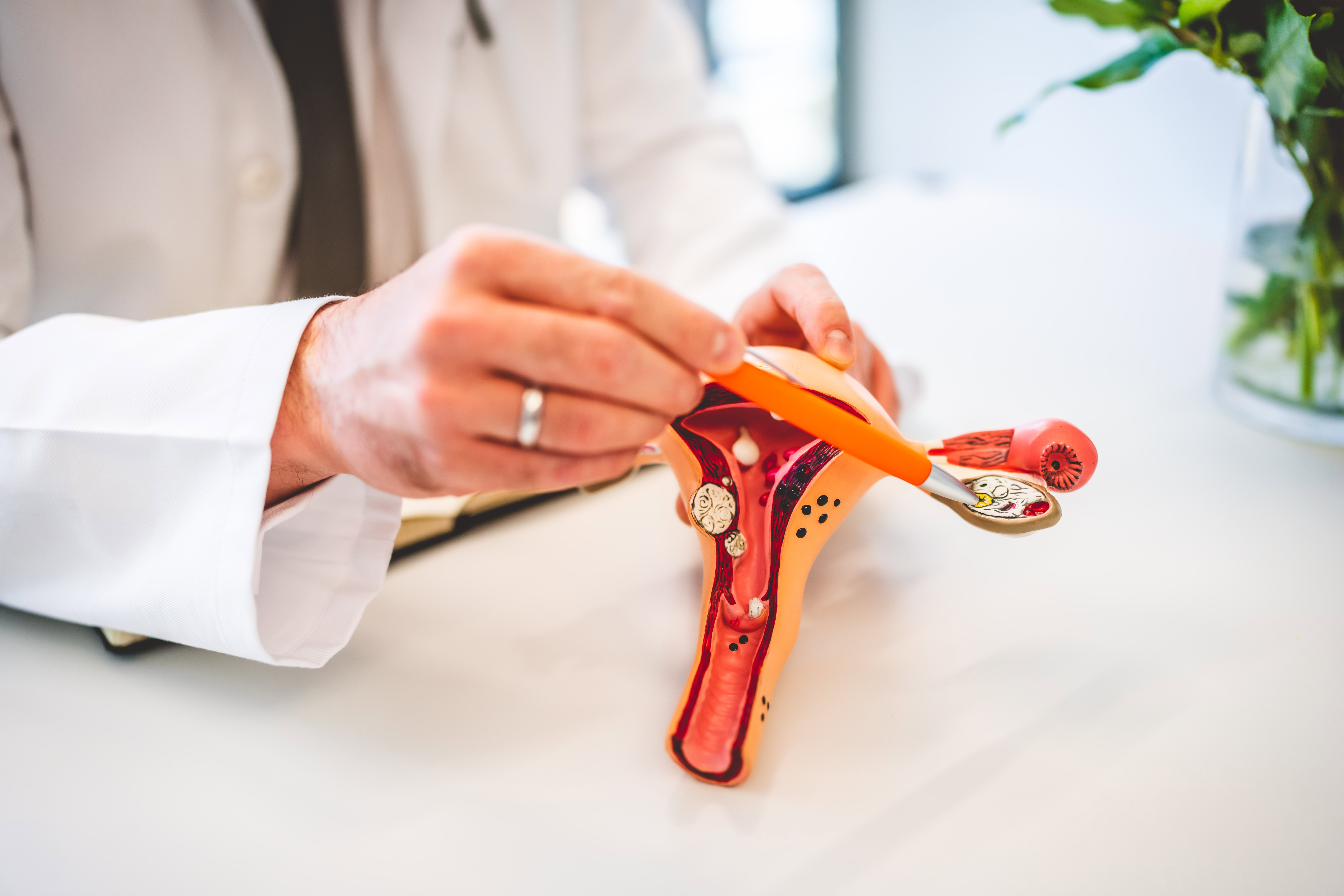 Gynäkologe Dr. Gantert zeigt etwas an Uterus Modell