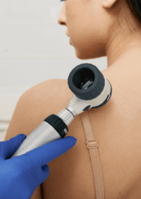 Hautscreening wird an Rücken einer Frau durchgeführt