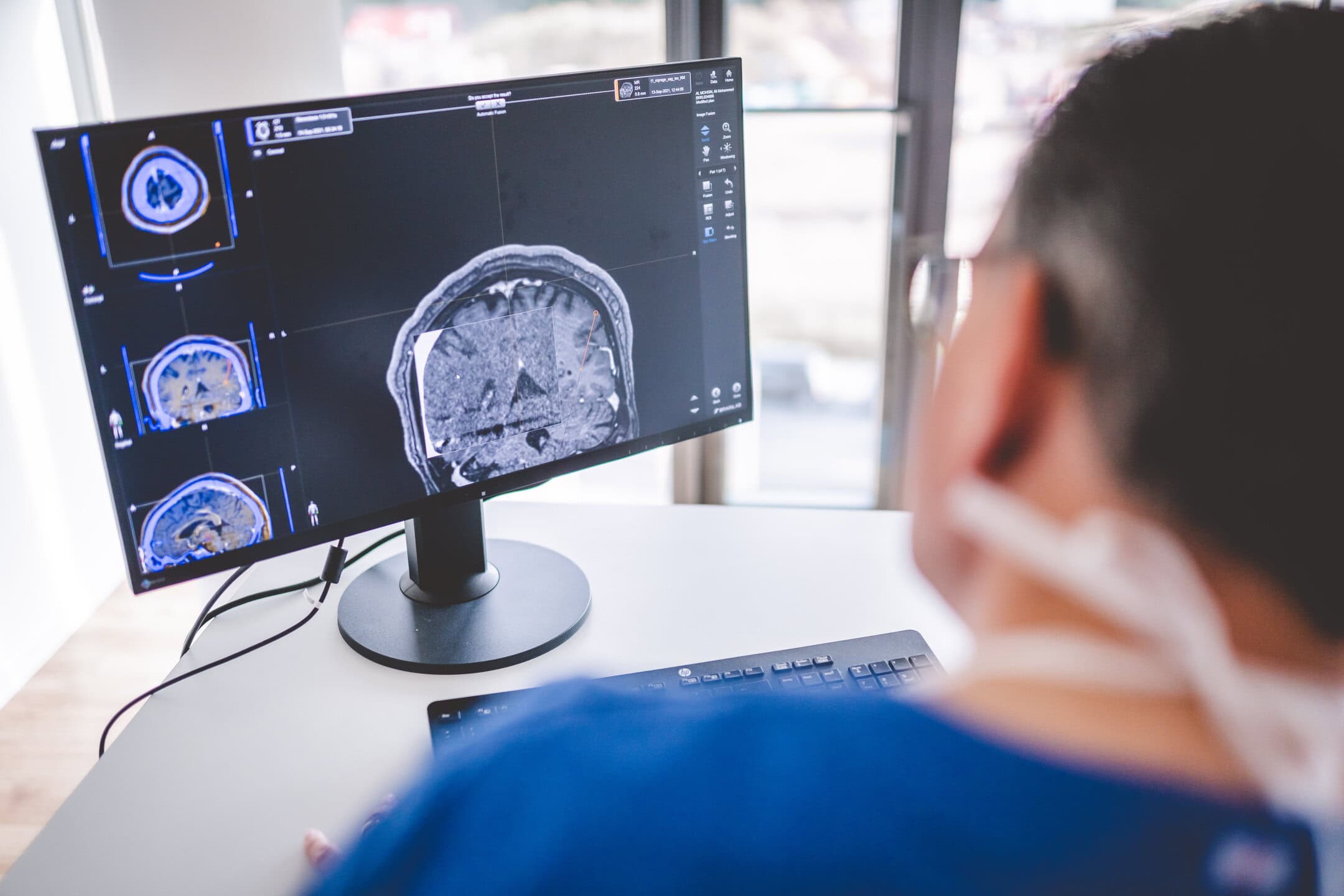 CT/MRT Aufnahmen eines Gehirns auf einem Computerbildschirm