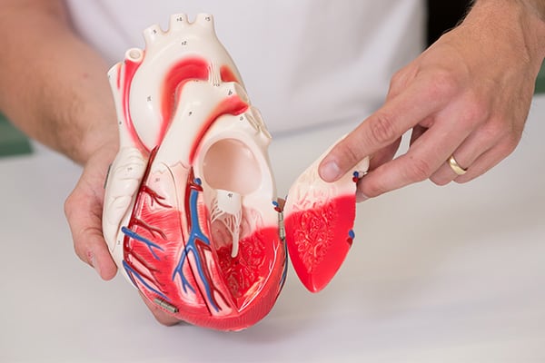 Kardiologie-bonn Herz Modell
