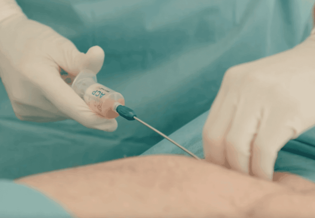 Eine Hand mit Handschuhen injiziert Flüssigkeit aus einer Spritze in einen Arm.