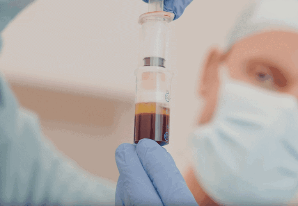 Mittel zur Arthrose-Behandlung