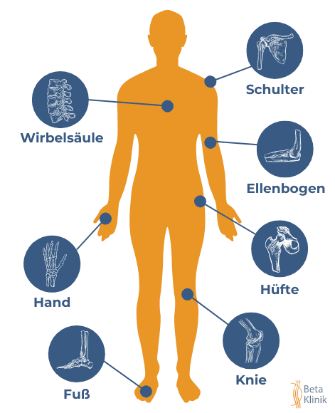 Ein Körper mit verschiedenen Bereichen hervorgehoben.