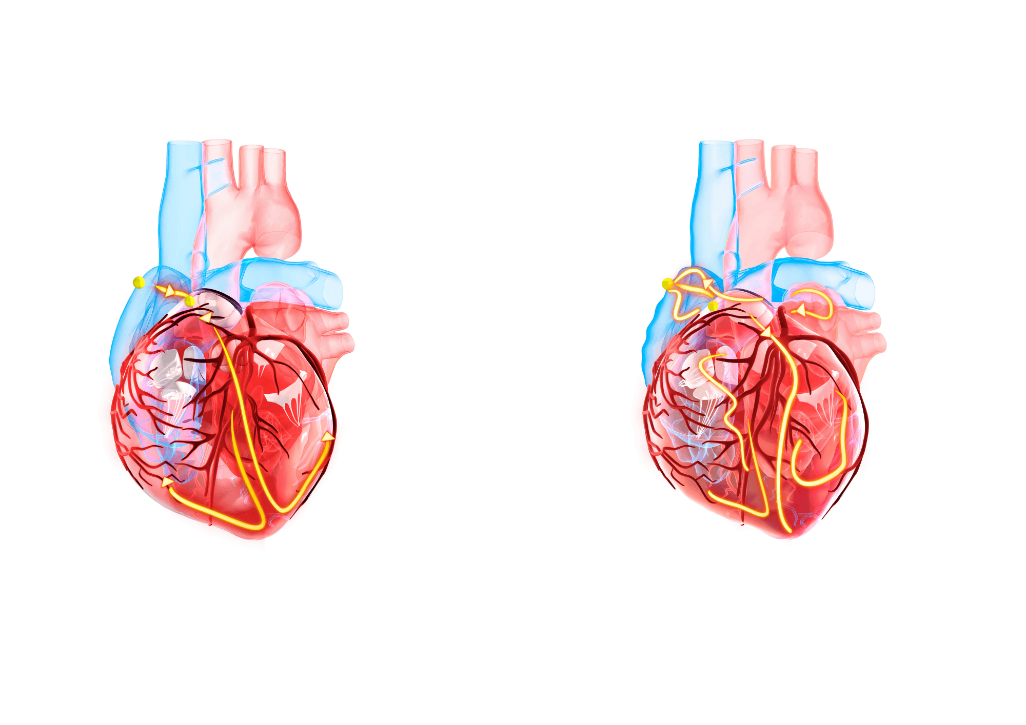 Gezeichnete Abbildung von einem Herzen