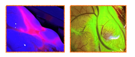 Fluoreszenzfarbstoffen