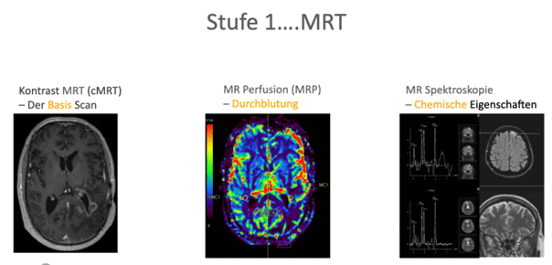 Diagnostik Stufe 1: die MRT Untersuchung