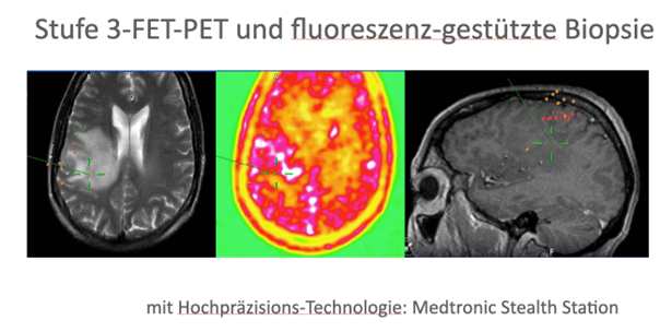 Stufe 3