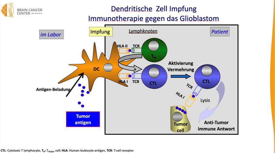Der Ablauf der Impfung mit Dendritischen Zellen: die Dendritische Zellen werden im Labor gebaut und unter die Haut gespritzt: im Lymphknoten erfolgt dann die Programmierung der Abwehrzellen