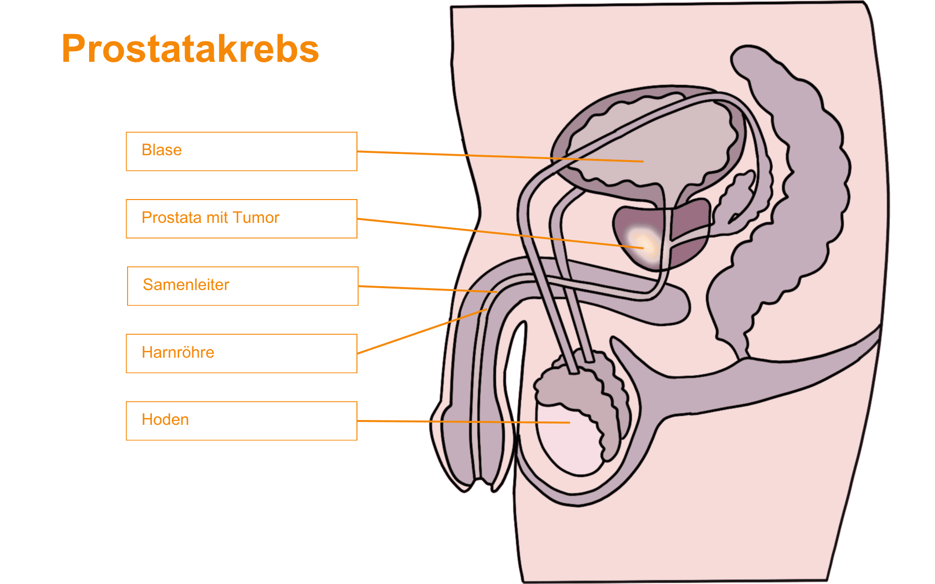 Abbildung der männlichen Anatomie mit Blase, Samenblase, Prostata, Samenleiter, Harnröhre und Hoden